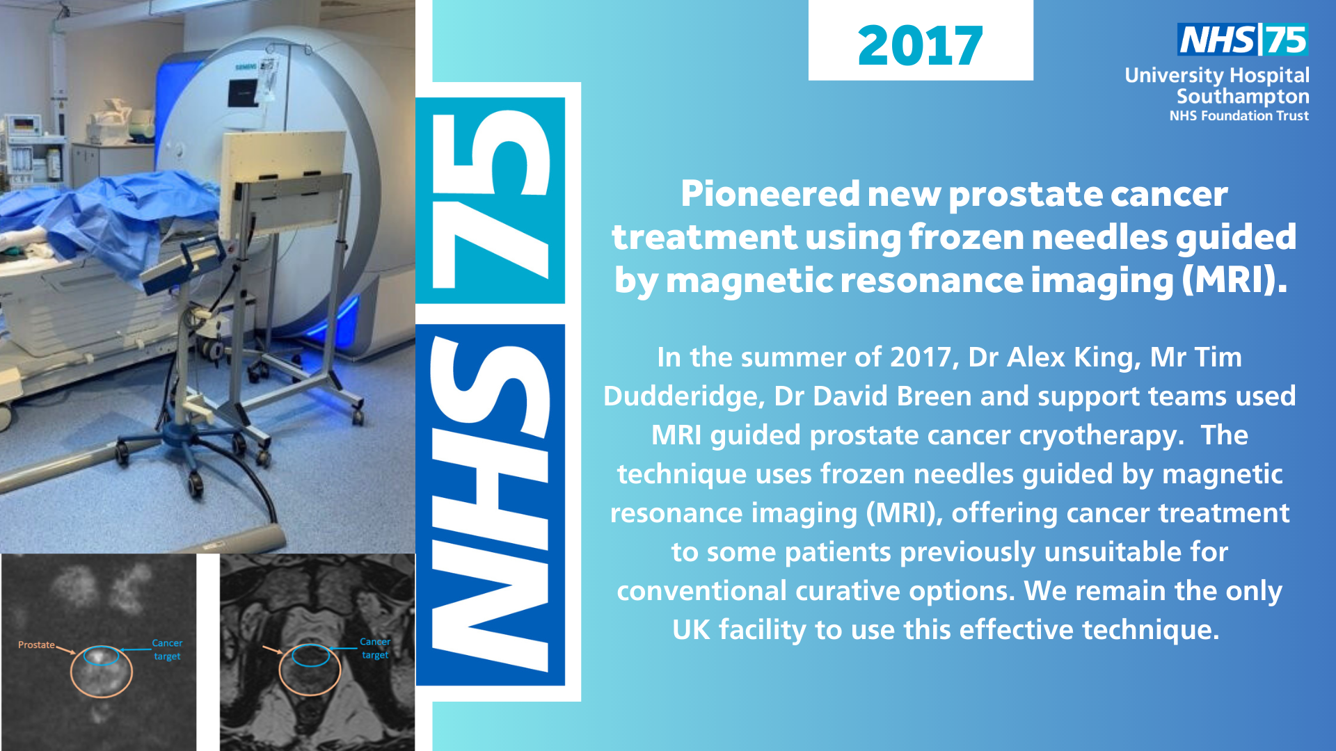 Pioneered new prostate cancer treatment using frozen needles guided by magnetic resonance imaging (MRI)