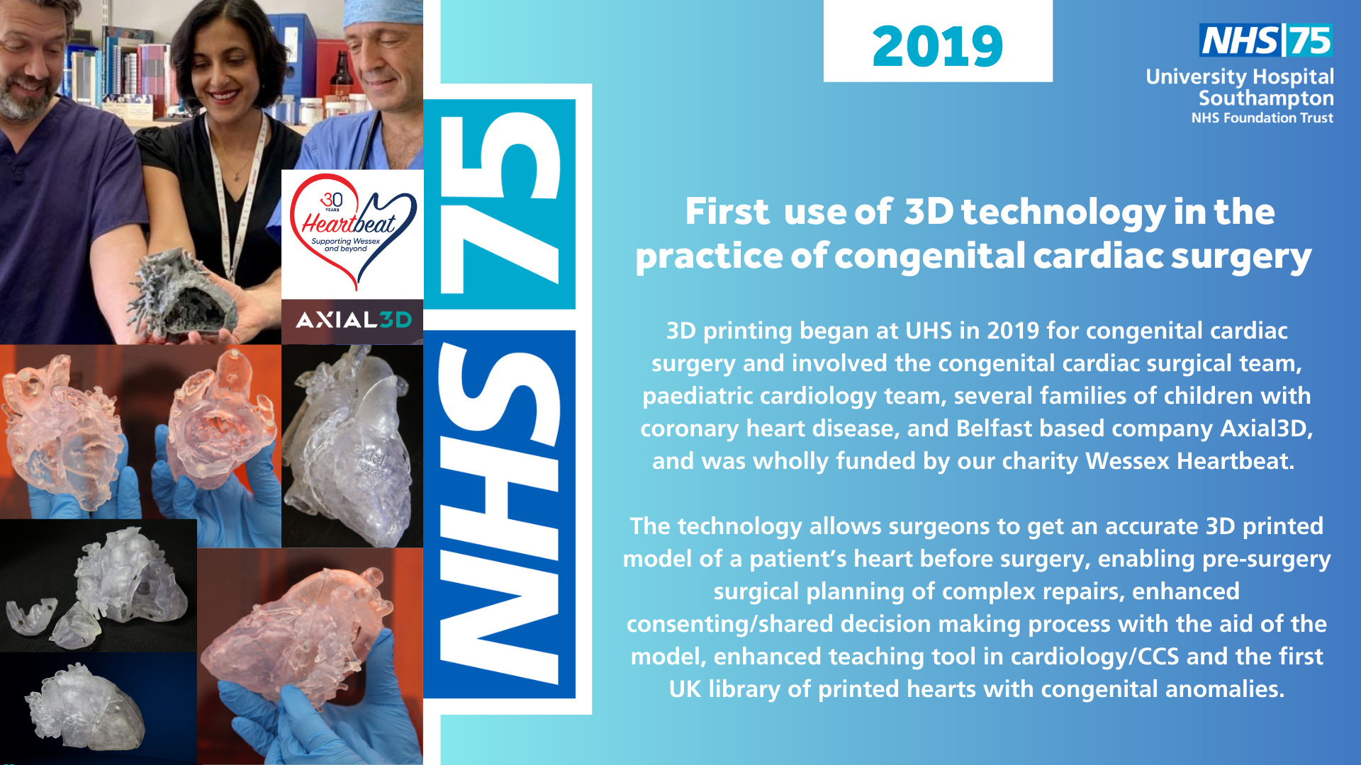 First use of 3D technology in the practice of congenital cardiac surgery