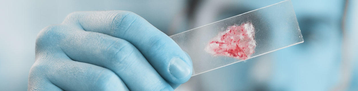 Researcher examining bacteria sample