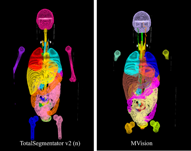 Side-by-side visualization of contours generated by the open-source TotalSegmentator vs a commercial package (MVision)